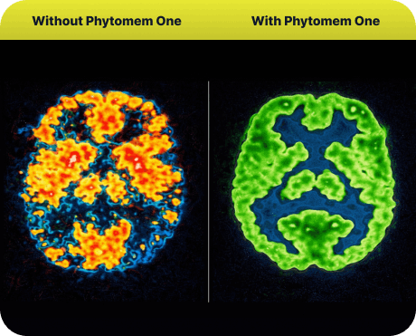 Phytomem One